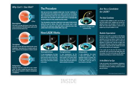 all laser lasik brochure 8 5″x14″ patient education concepts