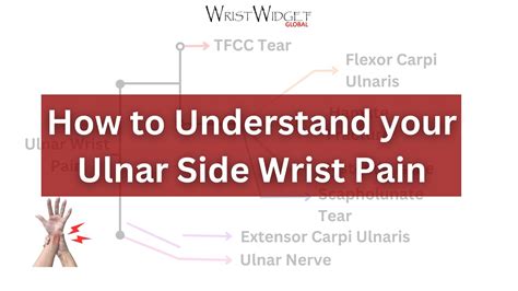 Understanding Your Ulnar Side Wrist Pain Youtube