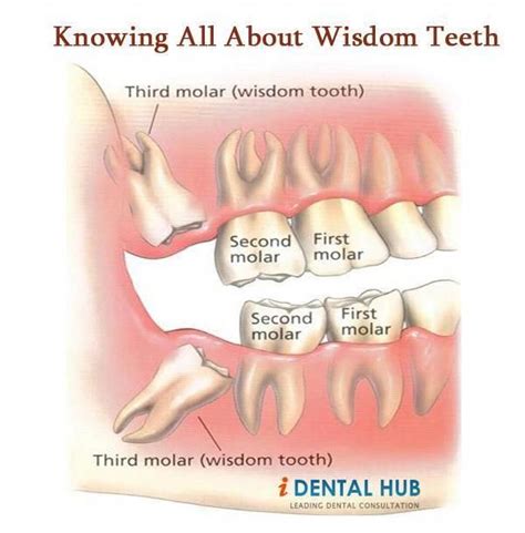 The aim here is to minimize the total amount of swelling. Rhetorical Sensitive Teeth Cold #toothpastedispensermurah ...