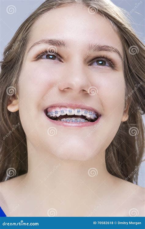 Closeup Portrait Of Caucasian Female Teenage Girl With Teeth Brackets