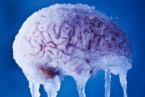 Mldspot Inilah Alasan Sebenarnya Kalau Es Krim Penyabab Brain Freeze