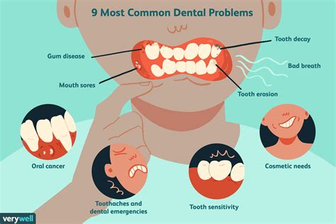 Najczęstsze problemy stomatologiczne Medycyna