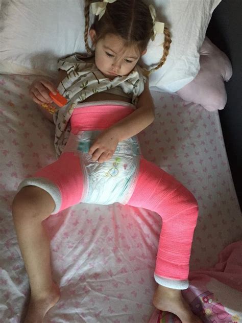 Little Hull Girl Stuck In Full Body Cast After Horrific Road Accident