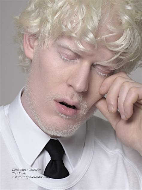 White Out Schön Magazine Albino Model Stephen Thompson Albino Men