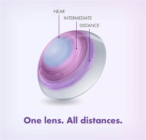 Presbyopia Multifocal Contact Lenses Soliman Paroli Eyecare