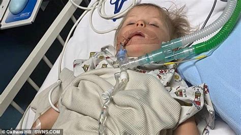 Shocking X Ray Shows Button Battery Lodged In Throat Of 11 Month Old