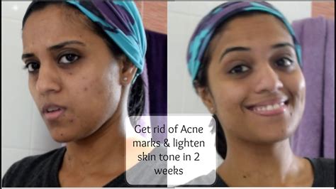 How To Lighten Skin In A Week Resipes My Familly