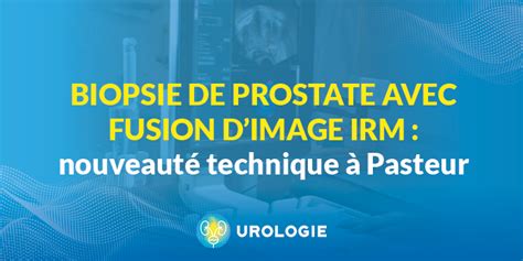 Biopsie De Prostate Avec Fusion Dimage Irm Nouveauté Technique à