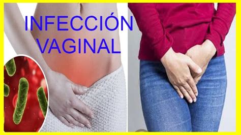 Todo Sobre Las Infecciones Vaginales Recetaparadiabetico