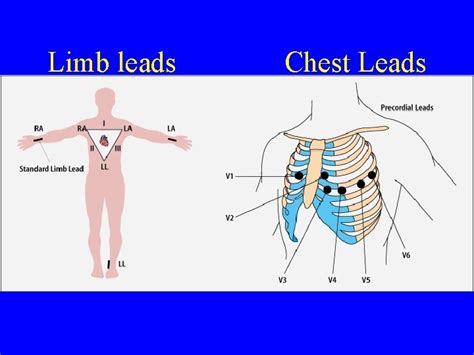 An Introduction To The 12 Lead Ecg Dr