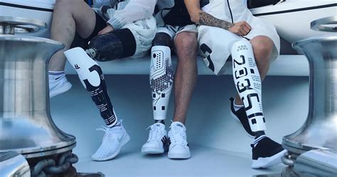 Prosthetic Leg Covers As Custom Wearable Art
