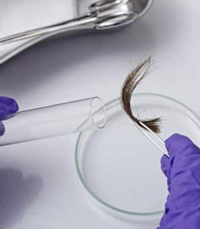 Hair Analysis - Dr.O Solutions for Natural Health