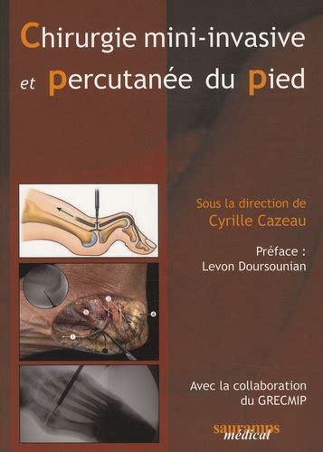 Chirurgie mini invasive et percutanée du pied de Cyrille Cazeau Livre Decitre