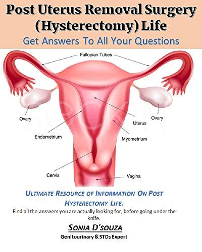 Post Uterus Removal Surgery Hysterectomy Life A Must Read Book For All The Women Who Are