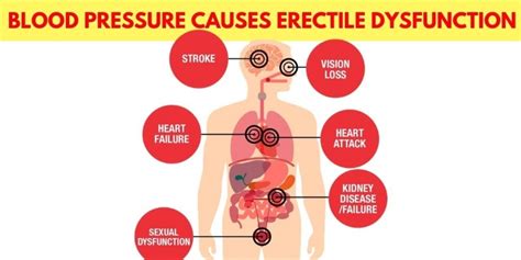High Blood Pressure And Erectile Dysfunction Causes And Treatment