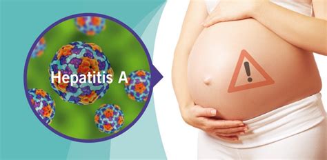 Contagio de hepatitis A causas síntomas y tratamiento Meditip