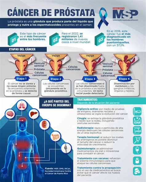 Cancer De Prostata Infografía