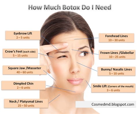 Botox Prices Around The World Cosmetic Medicine Md