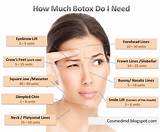 Botox Treatment For Sweating Photos