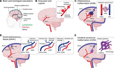 Cerebrovascular Anomalies Perspectives From Immunology And Cerebrospinal Fluid Flow
