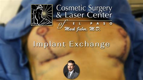 Implant Exchange Mastopexy Breast Lift Dr Mark Jabor YouTube