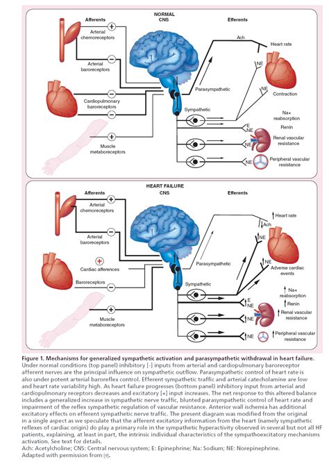 Baroreflex Activation Therapy For The Treatment Of Heart Failure