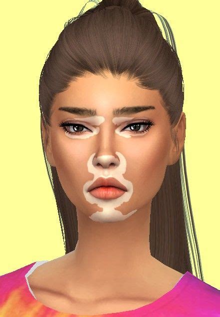 Vitiligo Overlay Click Photo For Download The Sims