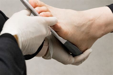 Foot Orthotics Fitting And Rehab Orthotics Plus Melbourne