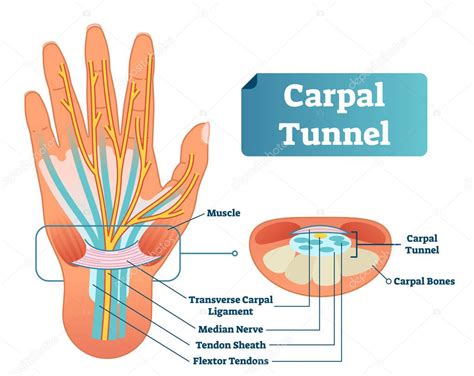 Carpal Tunnel Vector Illustration Scheme Medical Labeled Diagram