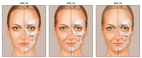 5 Common Signs Of Aging Ls Aesthetic Clinic