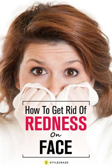 Home Remedies To Get Rid Of Redness On The Face Redness On Face Get
