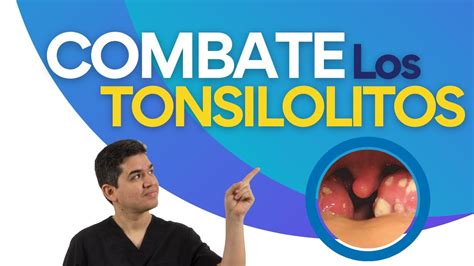 Episodio 18 Combate Los Tonsilolitos 🔥🦷 Tips Para Eliminarlos 💥