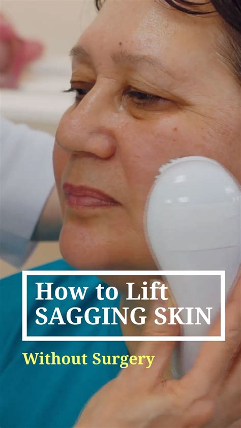 List Of Best Treatment For Sagging Neck And Jowls 2020 Ideas