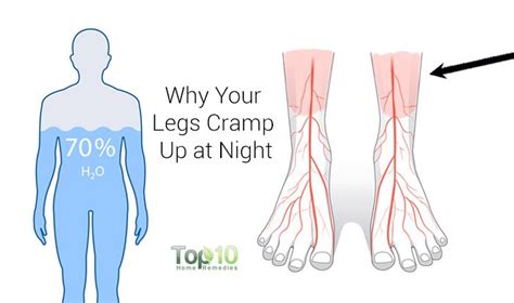 Reasons Why Your Legs Cramp Up At Night And How To Fix It Top 10 Home