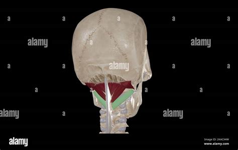 Suboccipital Muscles Colored Obliquus Capitis Inferior Stock Photo Alamy