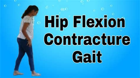 Hip Flexion Contracture Gait Youtube