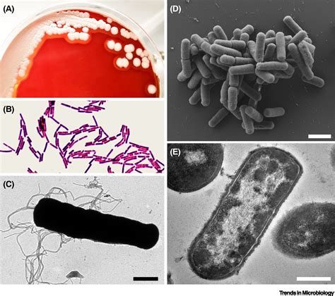 Bacillus Cereus Epidemiology Virulence Factors And Hostpathogen