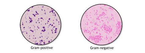 Gram Staining Principle And Procedure