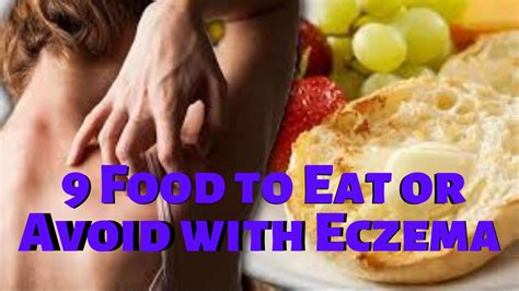 9 Food To Eat Or Avoid With Eczema Healthy Eating Youtube