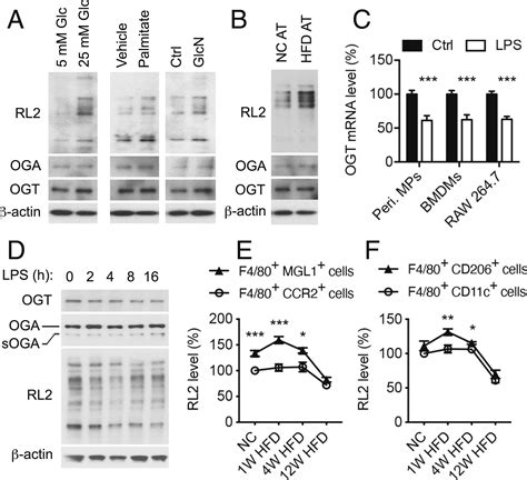 Ogt Suppresses S6k1 Mediated Macrophage Inflammation And Metabolic