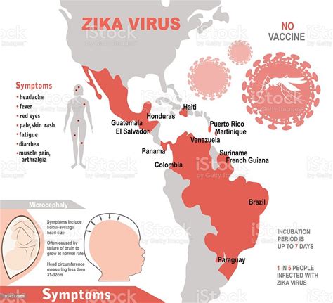 Zika Virus Infographic Elements Stock Illustration Download Image Now Aedes Mosquito Africa