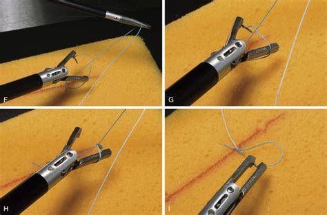 Endoscopic Knot Tying And Suturing Veterian Key