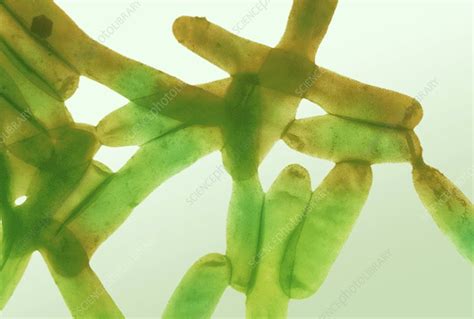Legionella Bacteria Light Micrograph Stock Image C0022991