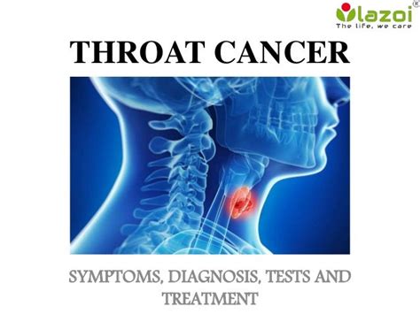 Throat Cancer Symptoms Pictures Throat Cancer Symptoms Pictures