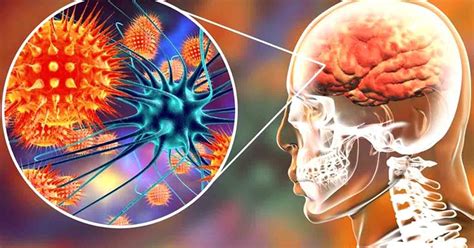 Functional Neurology Understanding Autoimmune Brain Disease