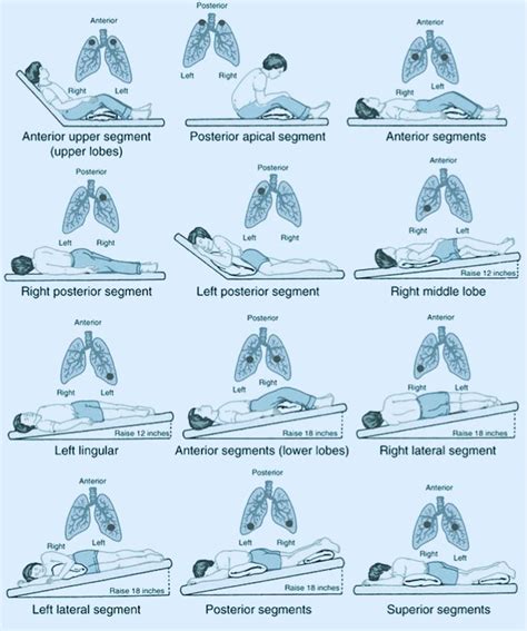 Postural Drainage Positions And Chest Physiotherapy Cpt Study Guide