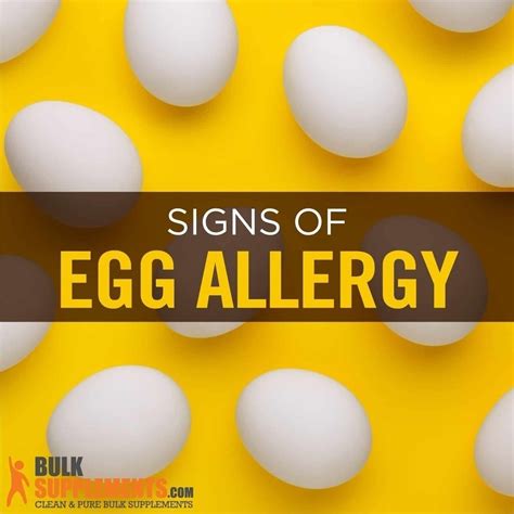 Tablo Read Egg Allergy Foods To Avoid Causes Signs And Treatment By