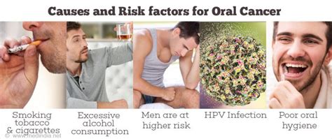 Causes And Risk Factors For Oral Cancer Medical Tech News The