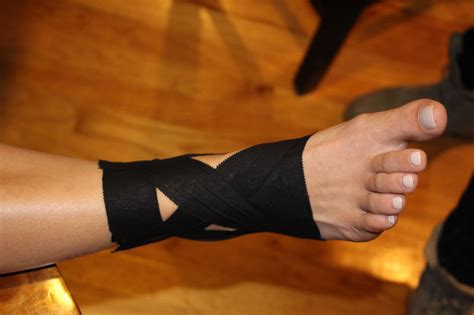 Ridj It Blog How To Tape A Sprained Ankle