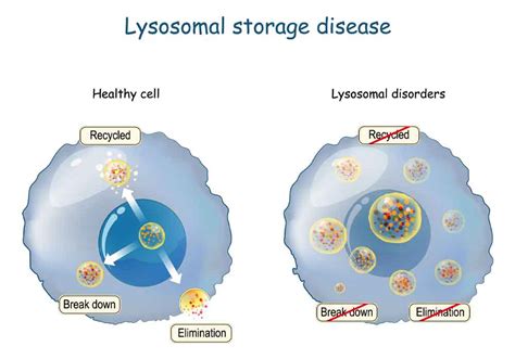 Cell And Gene Advanced Therapy In The Battle For Lysosomal Storage